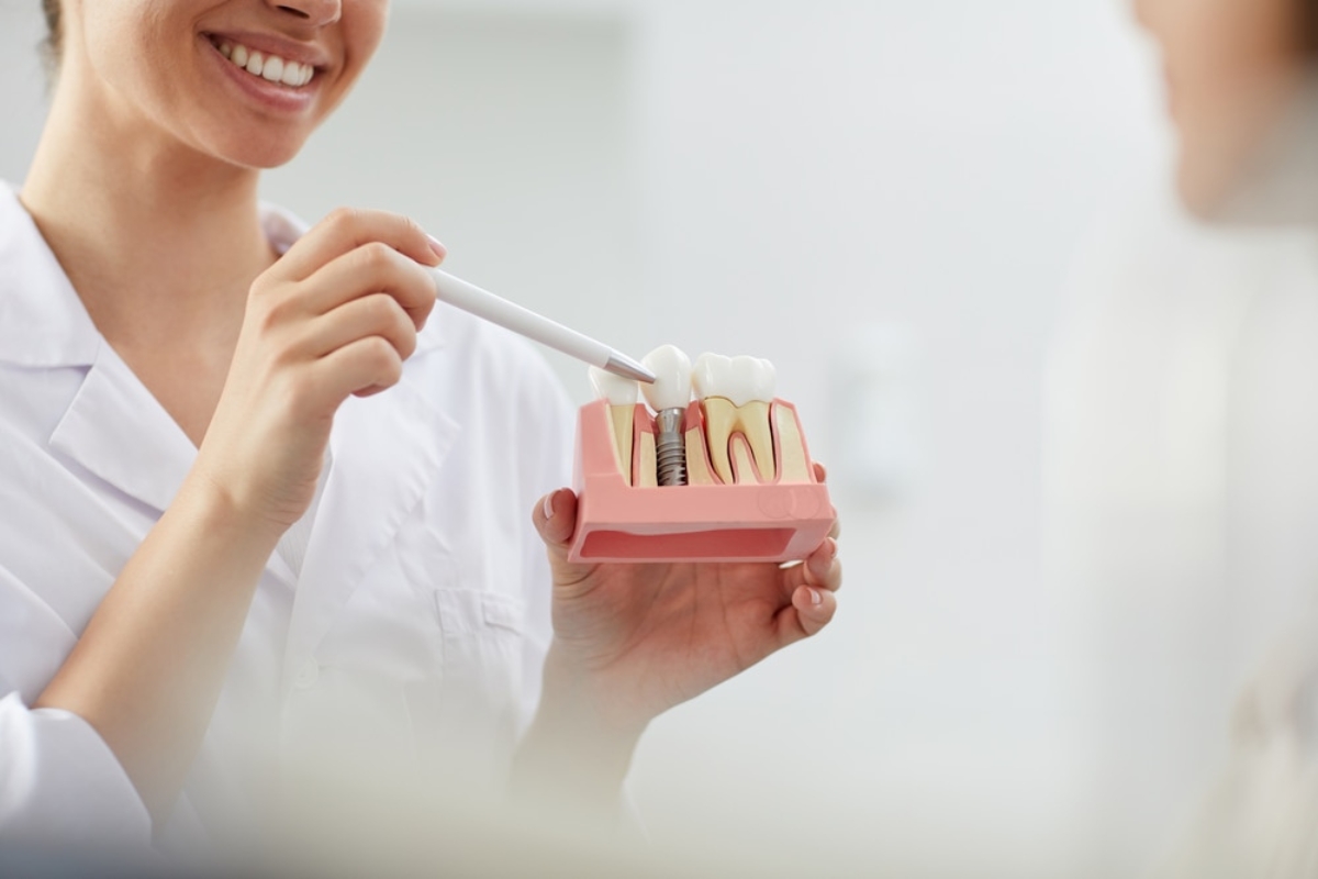 Why Replacing Missing Teeth Matters